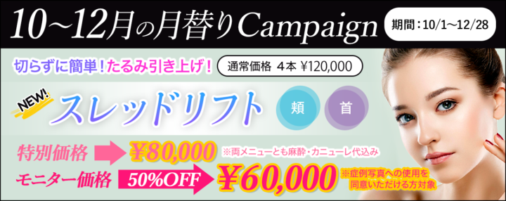 新登場!スレッドリフト!